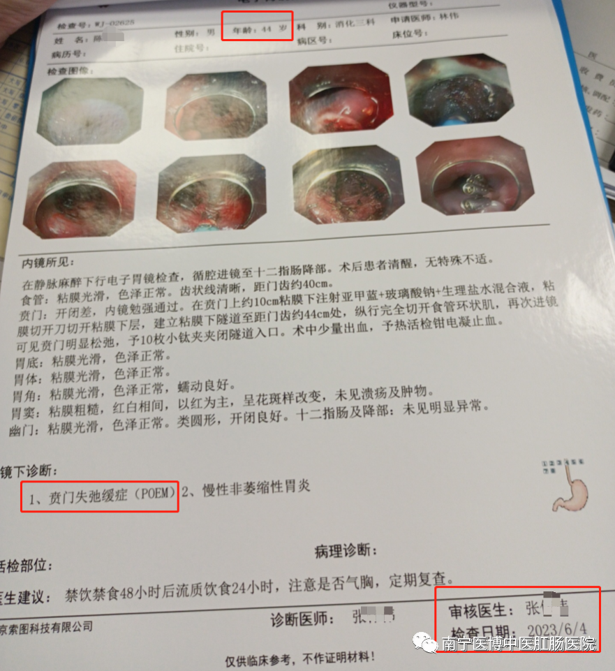   【新技術】南寧醫(yī)博醫(yī)院成功開展首例賁門失弛緩癥poem手術