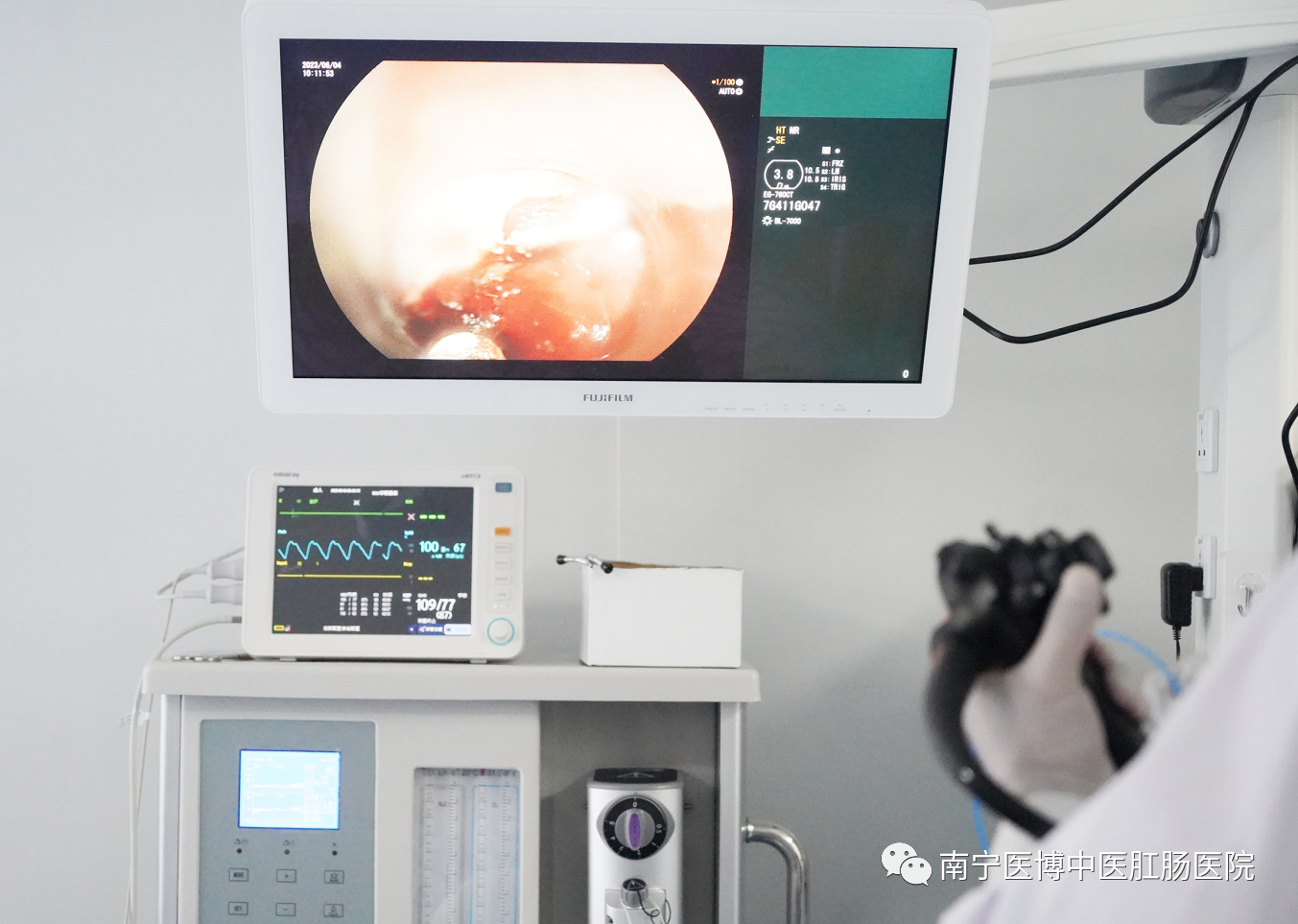   【新技術】南寧醫(yī)博醫(yī)院成功開展首例賁門失弛緩癥poem手術